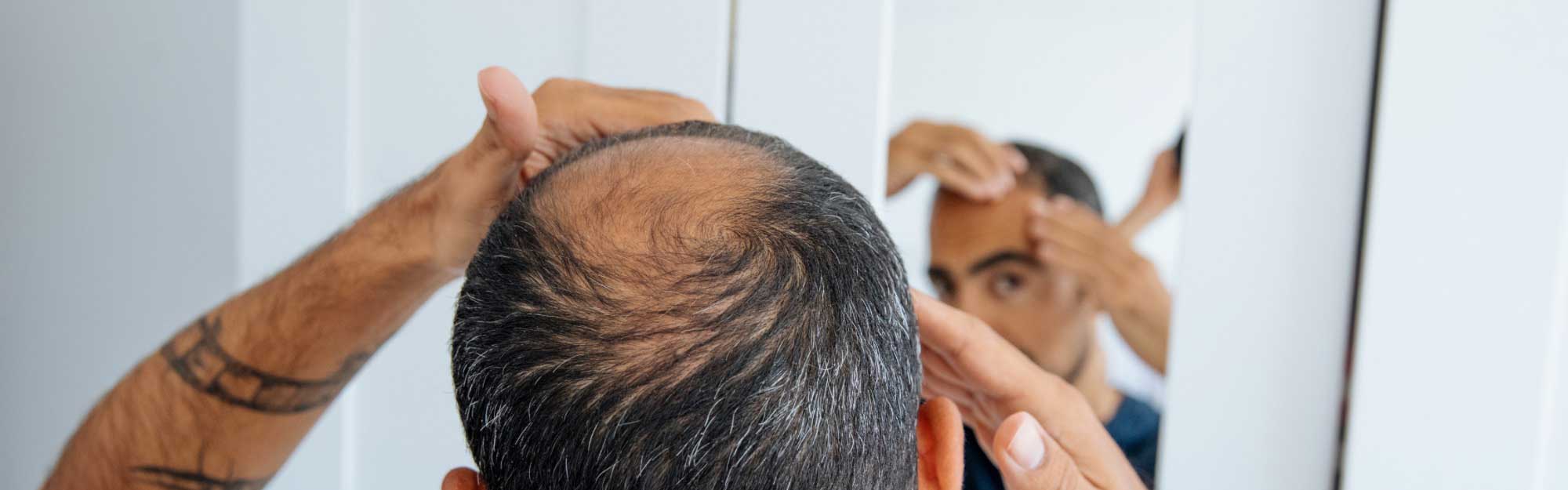 New Horizons Blog — Hair-Restoration-Header-Standard.jpg