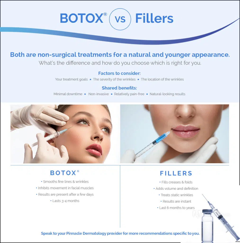 Botox vs Fillers